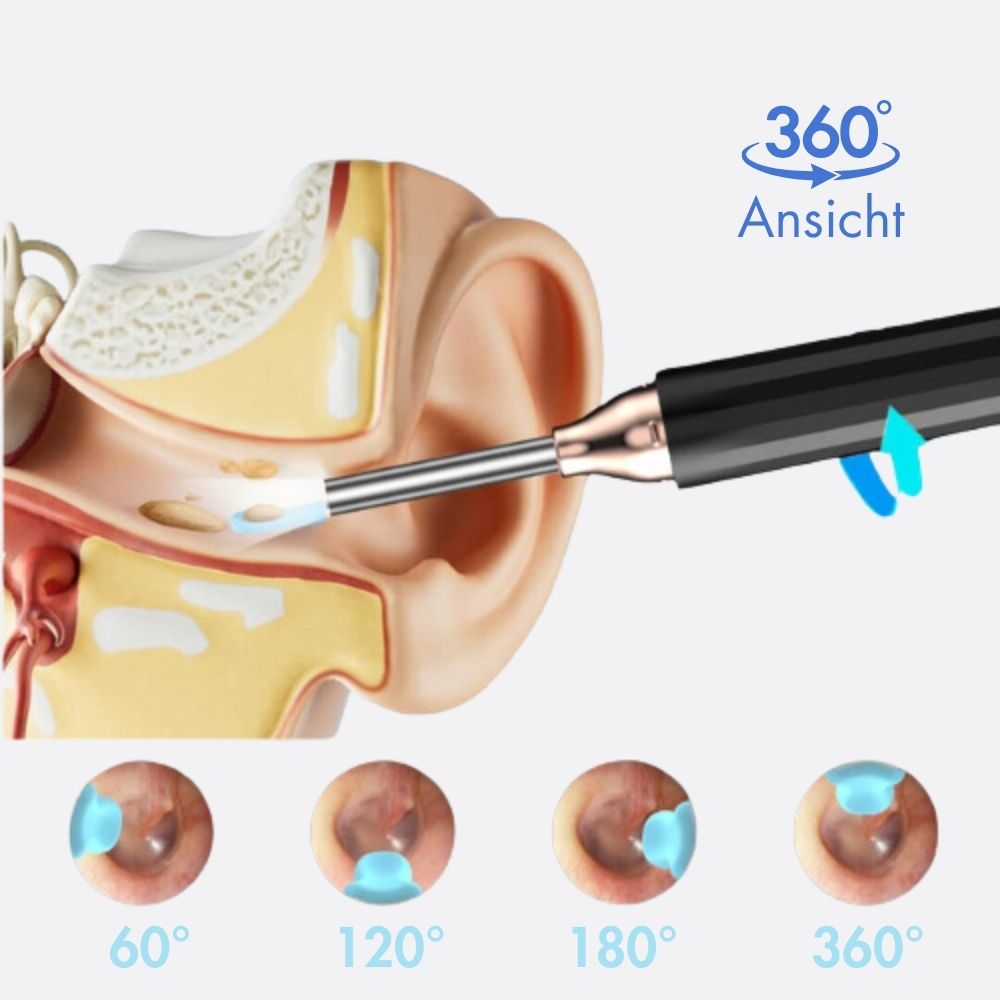 LUMEA® - Ohrenreiniger mit HD-Kamera